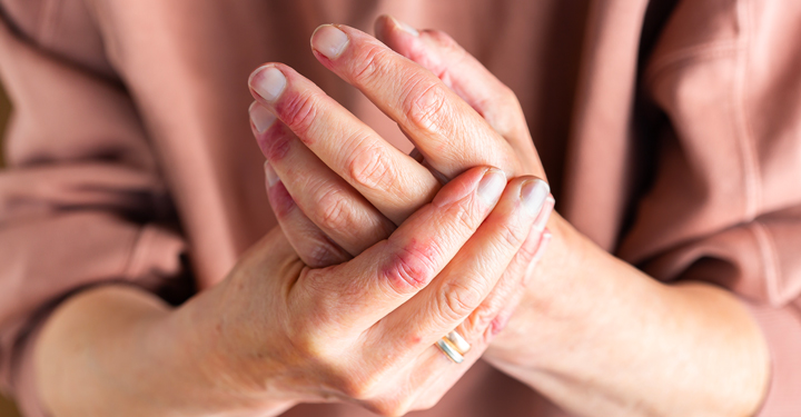 Malattie professionali cutanee: conoscere le cause per prevenire